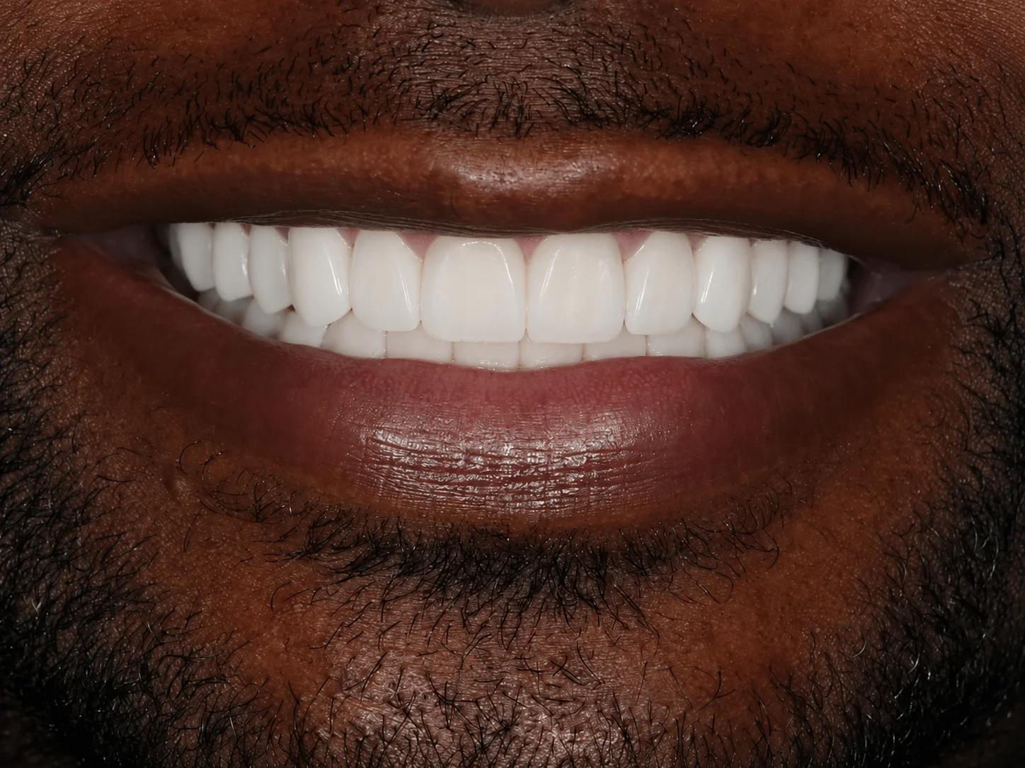 Color and proportion correction After