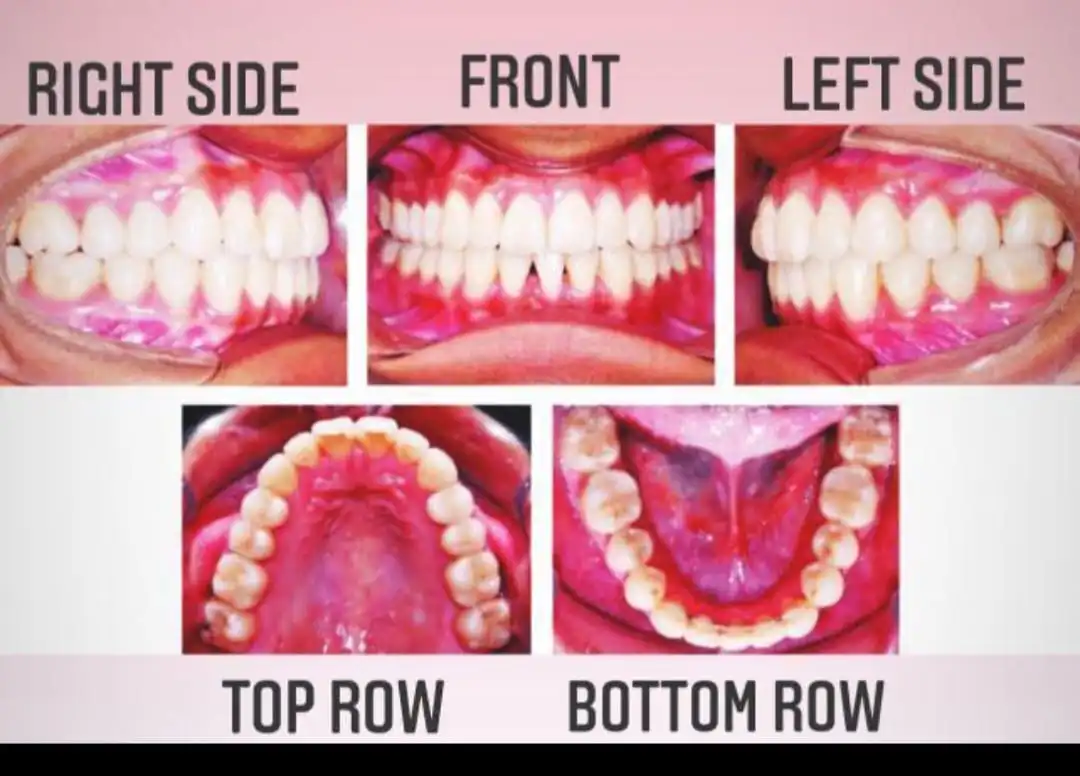 Photo guide for dental evaluation